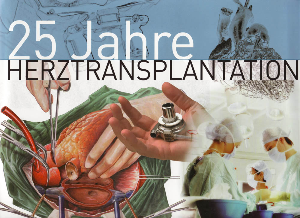 25 Jahre Herztransplantation am Wiener AKH